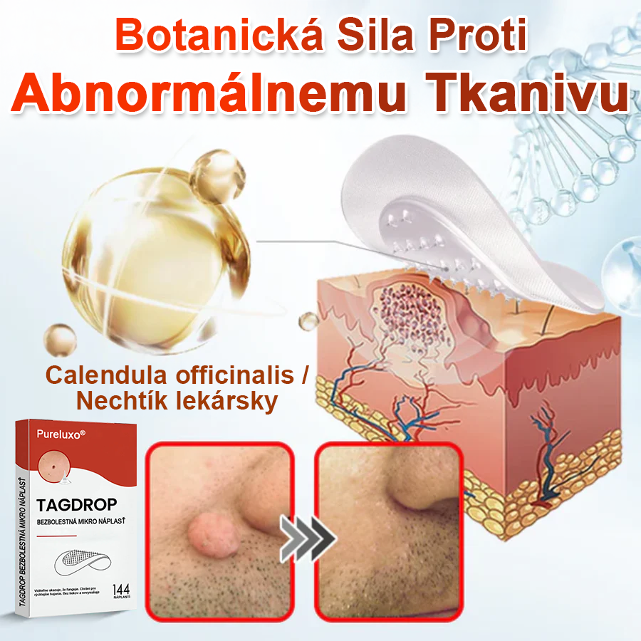 🌈Pureluxo® Náplasť na odstránenie kožných výrastkov s mikroihličkami