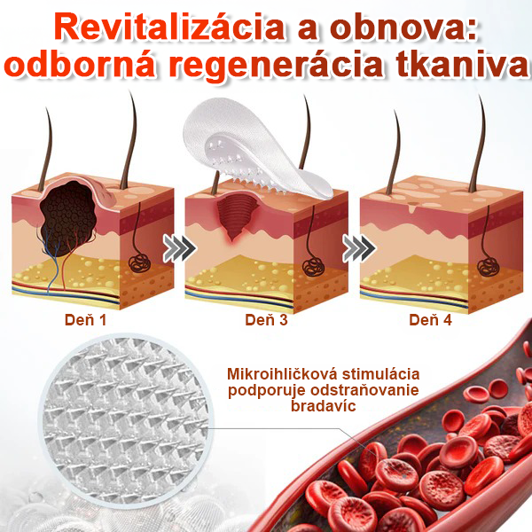 🌈Pureluxo® Náplasť na odstránenie kožných výrastkov s mikroihličkami