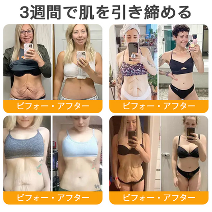 🌿 TLOPA® 蜂毒スキンリペアクリーム 🔥【最終日】本日限定 80%オフ！🌟🌟