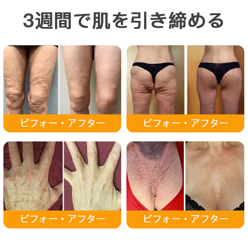 🌿 TLOPA® 蜂毒スキンリペアクリーム 🔥【最終日】本日限定 80%オフ！🌟🌟