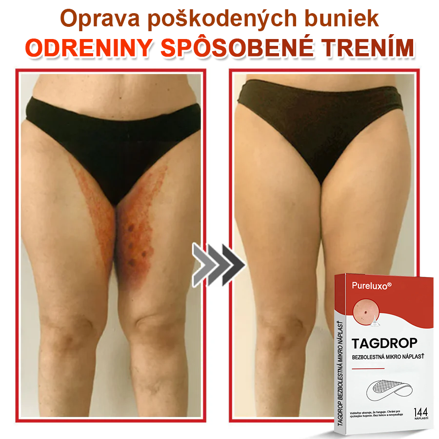 🌈Pureluxo® Náplasť na odstránenie kožných výrastkov s mikroihličkami