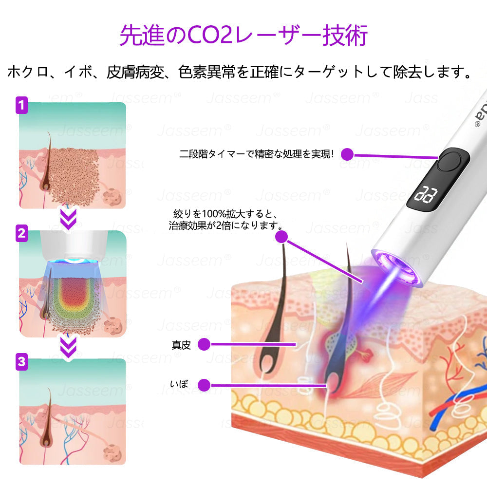 Bikenda® 高性能CO₂レーザーペン 🛫（痛みなし・面倒なしで、イボ・ほくろ・シミ・小さな肌のふくらみをやさしく除去！）お肌のケアにおすすめの非侵襲的アイテムだよ！