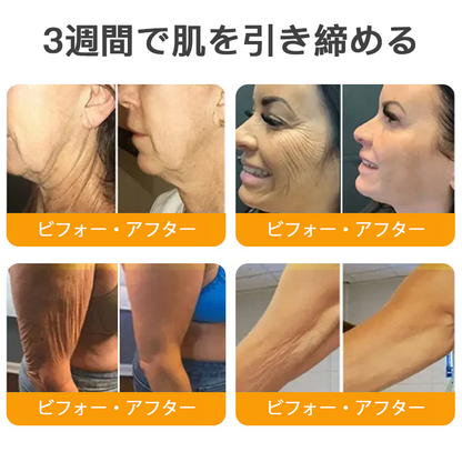 🌿 TLOPA® 蜂毒スキンリペアクリーム 🔥【最終日】本日限定 80%オフ！🌟🌟